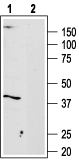 Anti Adenosine A3 Receptor Adora3 Antibody r 004 Alomone Labs