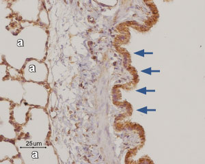 Anti Adenosine A3 Receptor Adora3 Antibody r 004 Alomone Labs